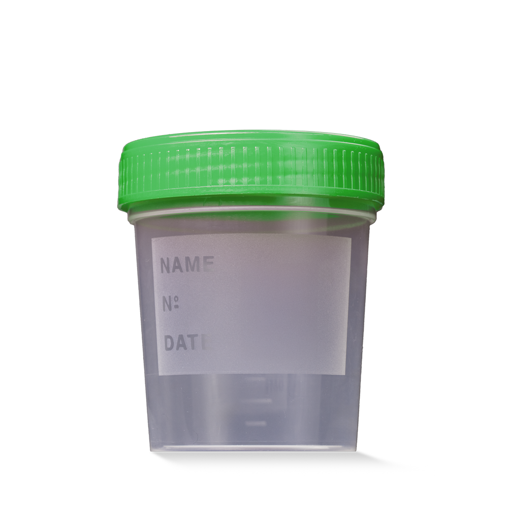PP Urinsammelbehälter mit Schraubdeckel, 100 ml graduiert, Farbe transparent, milchig, grün
