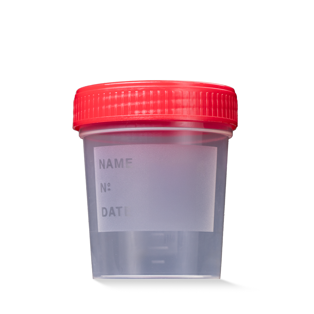PP Urinsammelbehälter mit Schraubdeckel, 100 ml, Farbe transparent, milchig, rot